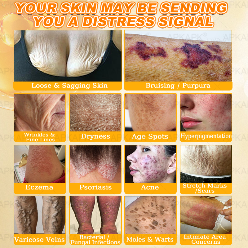 Made and Shipped from USA ✨✨𝖠𝖯𝖪𝖠𝖯𝖪® 𝖡𝖾𝖾 𝗏𝖾𝗇𝗈𝗆 𝖲𝗄𝗂𝗇 𝖱𝖾𝗌𝗍𝗈𝗋𝖺𝗍𝗂𝗈𝗇 𝖢𝗋𝖾𝖺𝗆