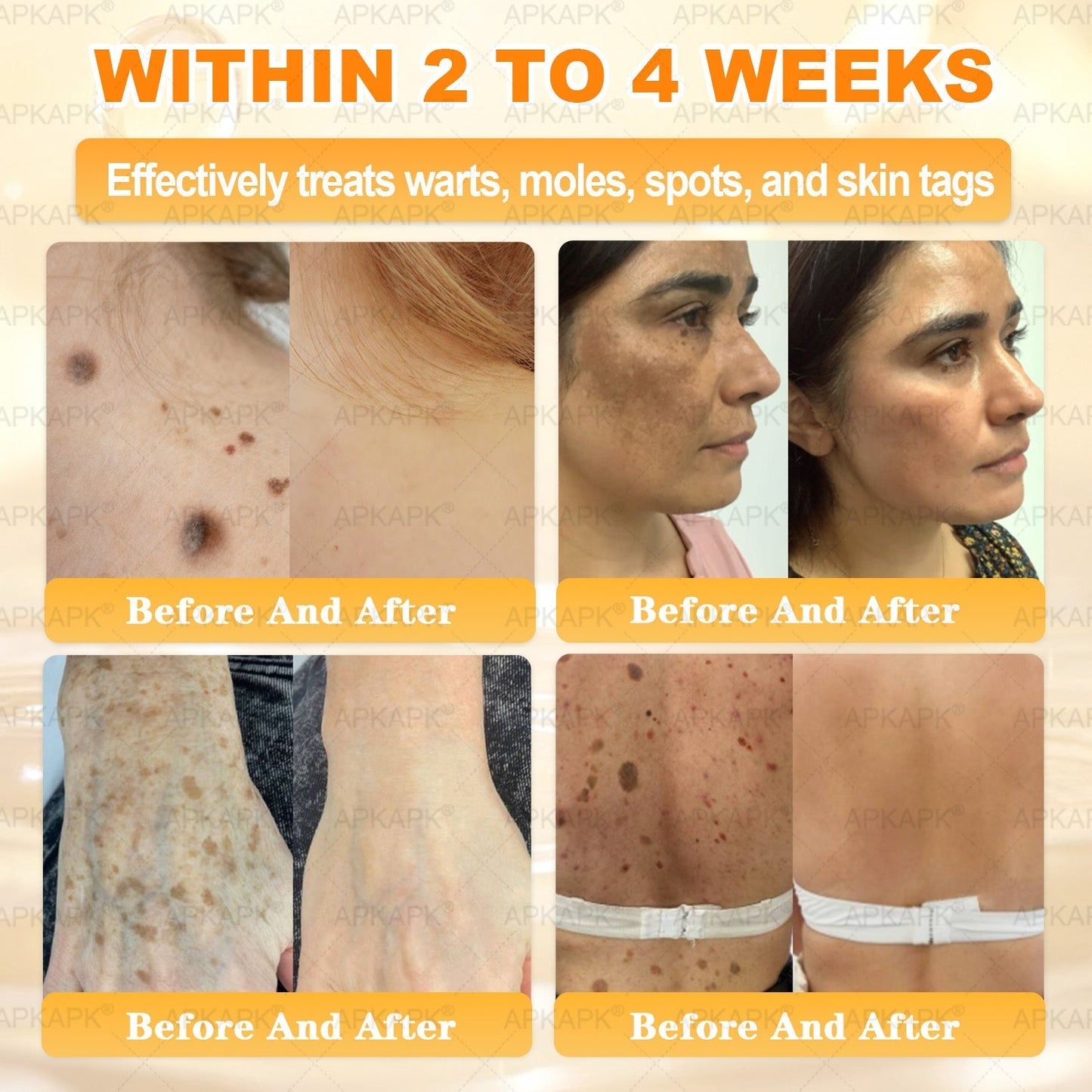 Made and Shipped from USA ✨✨𝖠𝖯𝖪𝖠𝖯𝖪® 𝖡𝖾𝖾 𝗏𝖾𝗇𝗈𝗆 𝖲𝗄𝗂𝗇 𝖱𝖾𝗌𝗍𝗈𝗋𝖺𝗍𝗂𝗈𝗇 𝖢𝗋𝖾𝖺𝗆