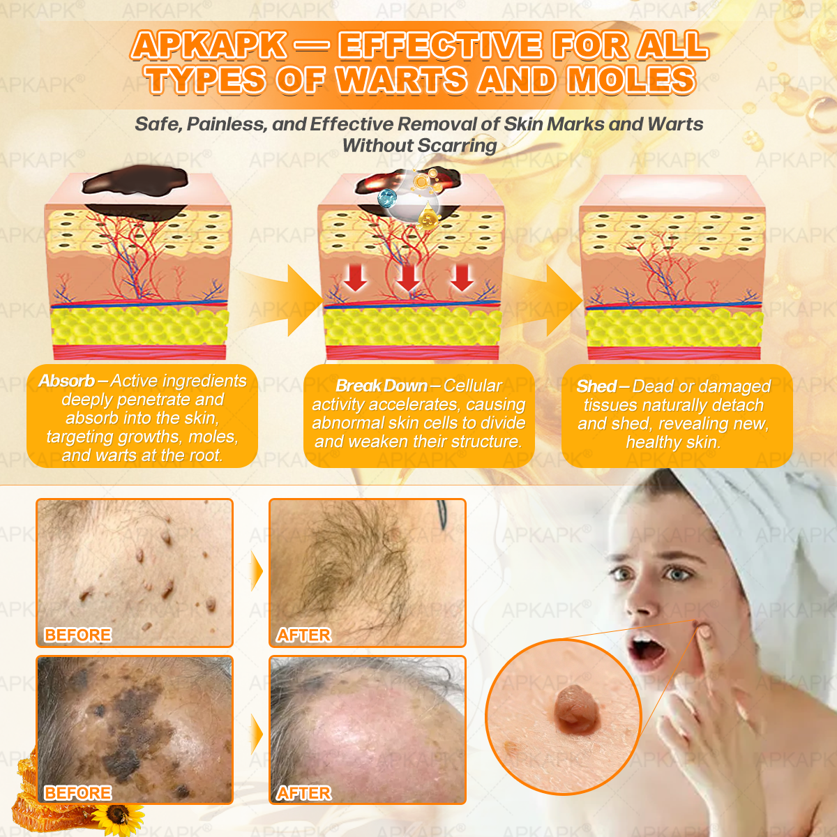 Made and Shipped from USA ✨✨𝖠𝖯𝖪𝖠𝖯𝖪® 𝖡𝖾𝖾 𝗏𝖾𝗇𝗈𝗆 𝖲𝗄𝗂𝗇 𝖱𝖾𝗌𝗍𝗈𝗋𝖺𝗍𝗂𝗈𝗇 𝖢𝗋𝖾𝖺𝗆