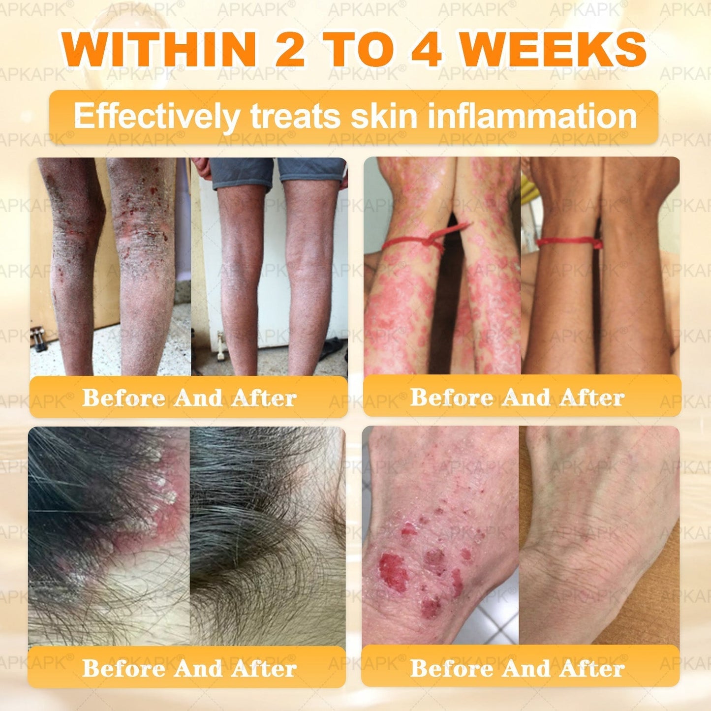 Made and Shipped from USA ✨✨𝖠𝖯𝖪𝖠𝖯𝖪® 𝖡𝖾𝖾 𝗏𝖾𝗇𝗈𝗆 𝖲𝗄𝗂𝗇 𝖱𝖾𝗌𝗍𝗈𝗋𝖺𝗍𝗂𝗈𝗇 𝖢𝗋𝖾𝖺𝗆