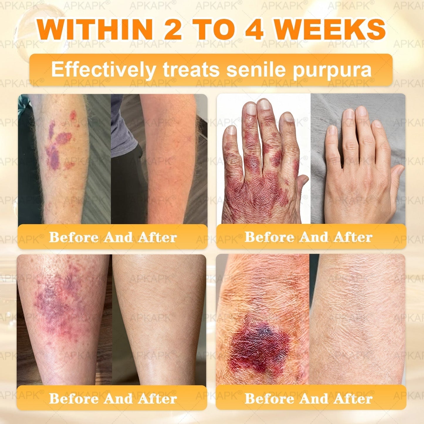 Made and Shipped from USA ✨✨𝖠𝖯𝖪𝖠𝖯𝖪® 𝖡𝖾𝖾 𝗏𝖾𝗇𝗈𝗆 𝖲𝗄𝗂𝗇 𝖱𝖾𝗌𝗍𝗈𝗋𝖺𝗍𝗂𝗈𝗇 𝖢𝗋𝖾𝖺𝗆