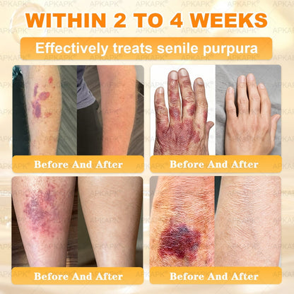 Made and Shipped from USA ✨✨𝖠𝖯𝖪𝖠𝖯𝖪® 𝖡𝖾𝖾 𝗏𝖾𝗇𝗈𝗆 𝖲𝗄𝗂𝗇 𝖱𝖾𝗌𝗍𝗈𝗋𝖺𝗍𝗂𝗈𝗇 𝖢𝗋𝖾𝖺𝗆