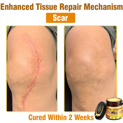 Natravor®𝐁𝐞𝐞 𝐕𝐞𝐧𝐨𝐦 𝐀𝐥𝐥-𝐢𝐧-𝐎𝐧𝐞 𝐂𝐫𝐞𝐚𝐦–🌸 Anti-aging,Hydrating, Skin Repair, Even Tone, Acne and Dark Spot Treatment, Wart and Mole Removal, Psoriasis Relief