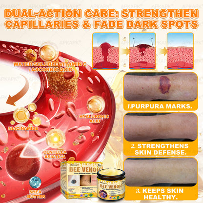 Made and Shipped from USA ✨✨𝖠𝖯𝖪𝖠𝖯𝖪® 𝖡𝖾𝖾 𝗏𝖾𝗇𝗈𝗆 𝖲𝗄𝗂𝗇 𝖱𝖾𝗌𝗍𝗈𝗋𝖺𝗍𝗂𝗈𝗇 𝖢𝗋𝖾𝖺𝗆