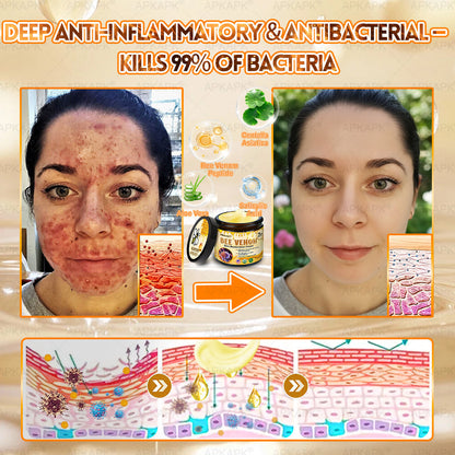 Made and Shipped from USA ✨✨𝖠𝖯𝖪𝖠𝖯𝖪® 𝖡𝖾𝖾 𝗏𝖾𝗇𝗈𝗆 𝖲𝗄𝗂𝗇 𝖱𝖾𝗌𝗍𝗈𝗋𝖺𝗍𝗂𝗈𝗇 𝖢𝗋𝖾𝖺𝗆