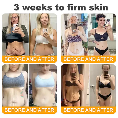 Natravor®𝐁𝐞𝐞 𝐕𝐞𝐧𝐨𝐦 𝐀𝐥𝐥-𝐢𝐧-𝐎𝐧𝐞 𝐂𝐫𝐞𝐚𝐦–🌸 Anti-aging,Hydrating, Skin Repair, Even Tone, Acne and Dark Spot Treatment, Wart and Mole Removal, Psoriasis Relief