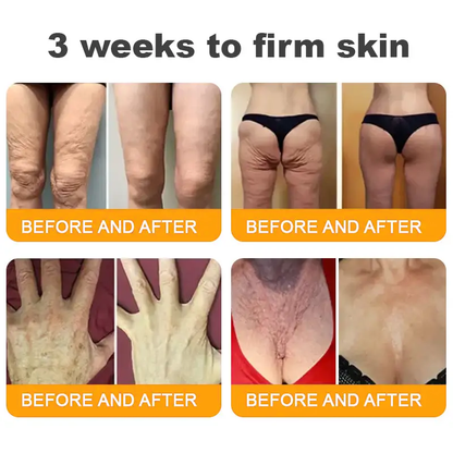 Natravor®𝐁𝐞𝐞 𝐕𝐞𝐧𝐨𝐦 𝐀𝐥𝐥-𝐢𝐧-𝐎𝐧𝐞 𝐂𝐫𝐞𝐚𝐦–🌸 Anti-aging,Hydrating, Skin Repair, Even Tone, Acne and Dark Spot Treatment, Wart and Mole Removal, Psoriasis Relief