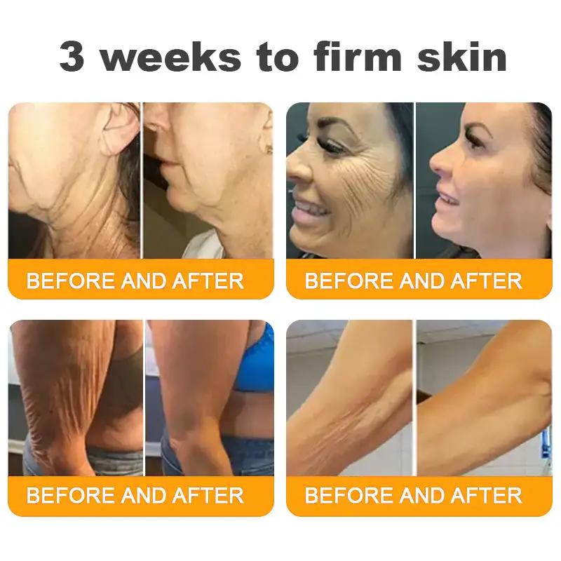 Natravor®𝐁𝐞𝐞 𝐕𝐞𝐧𝐨𝐦 𝐀𝐥𝐥-𝐢𝐧-𝐎𝐧𝐞 𝐂𝐫𝐞𝐚𝐦–🌸 Anti-aging,Hydrating, Skin Repair, Even Tone, Acne and Dark Spot Treatment, Wart and Mole Removal, Psoriasis Relief