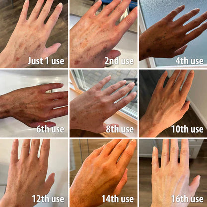 ✨Fast Dark Spot Remover-Natravor®  Melanin Correcting Facial Serum(🔥Last Day Promotion 60% OFF)