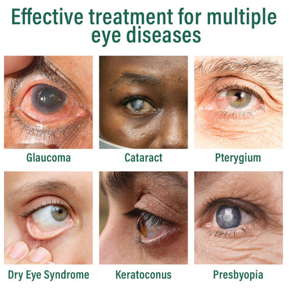 👩‍⚕️BQYOOMTM Nano Eye Drops Serum