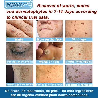 BQYOOMTM Magnesium skin repair cream👨‍⚕️NHS Approved (Psoriasis and Eczema Relief, Skin Repair, Even Tone, Acne and Dark Spot Treatment, Wart and Mole Removal)