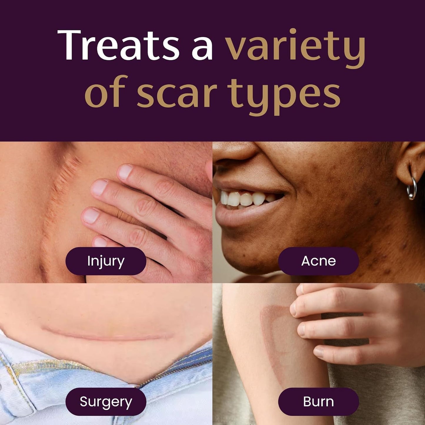 BQYOOMTM Advanced Scar Gel